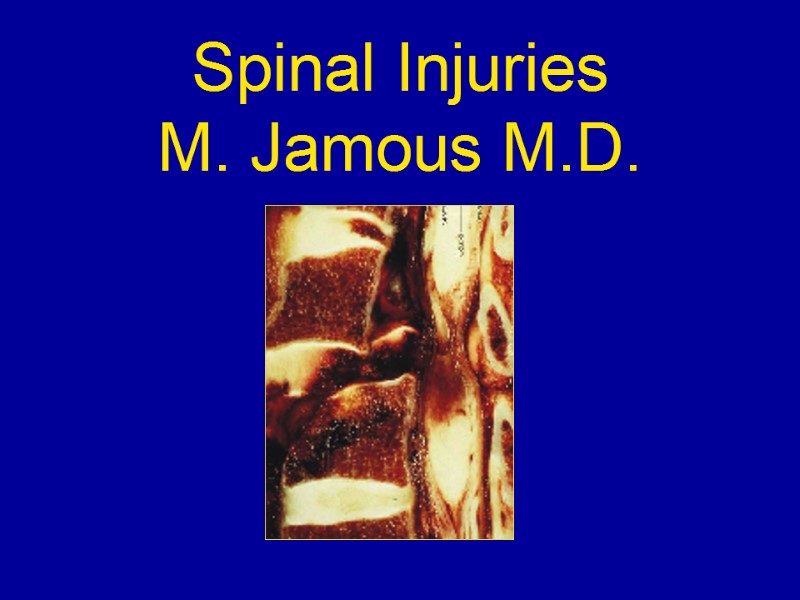Spinal Injuries M. Jamous M.D.